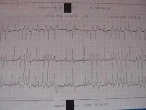 Electrocardiogramme cas - Apyvet Bourgeolles